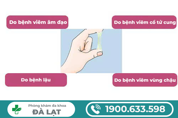 Hình ảnh minh họa